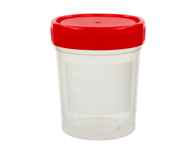 Urine Container With Red Cap – 60ml Sterile